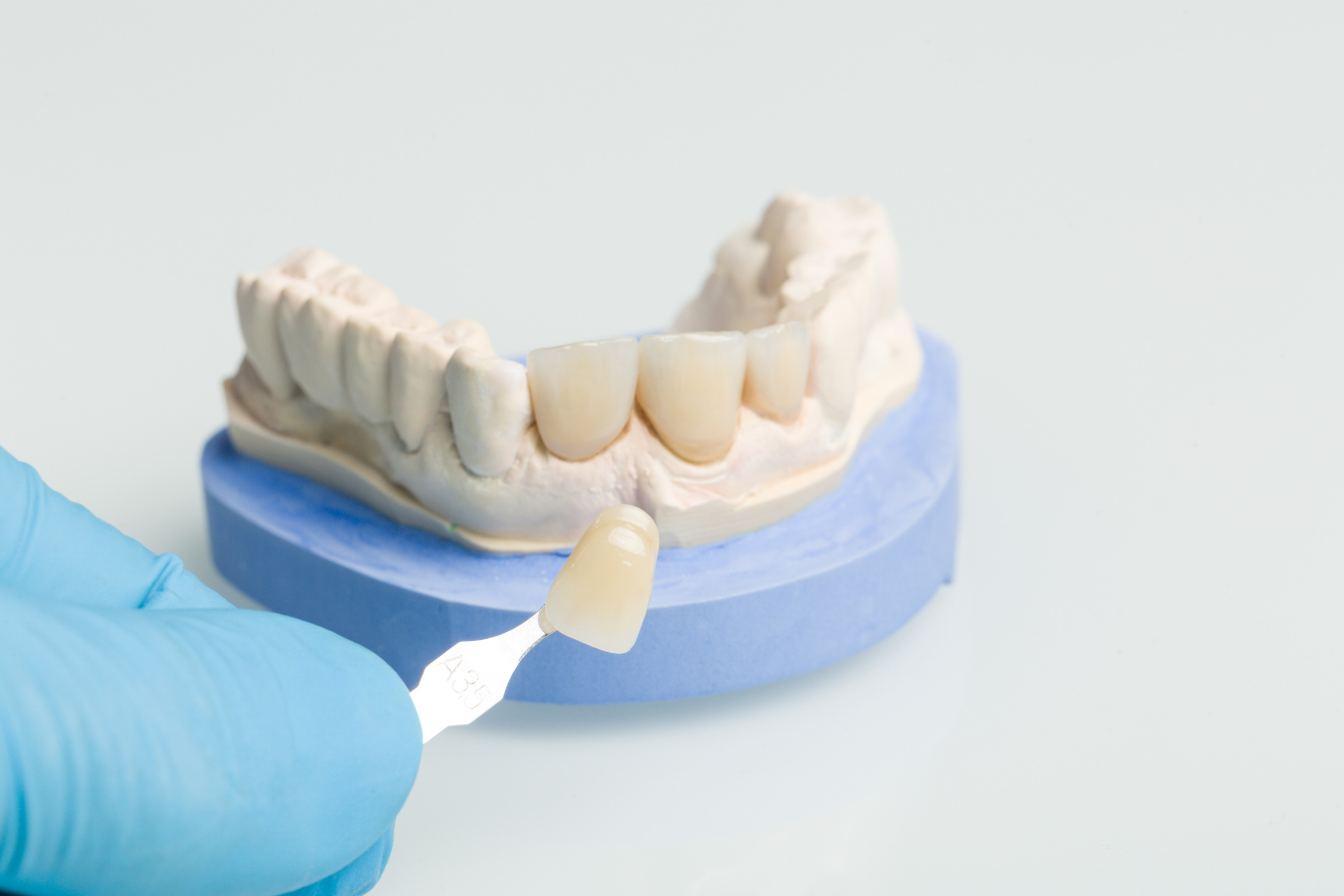 Using shade guide at dentures in dental lab to check veneer of tooth crown